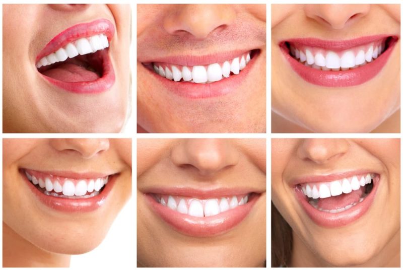 Cosmetic Dentistry
