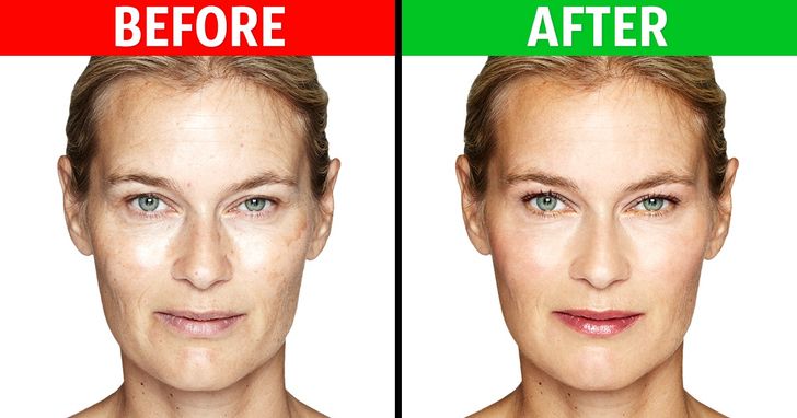 Best Ways to Get Rid of Facial Wrinkles