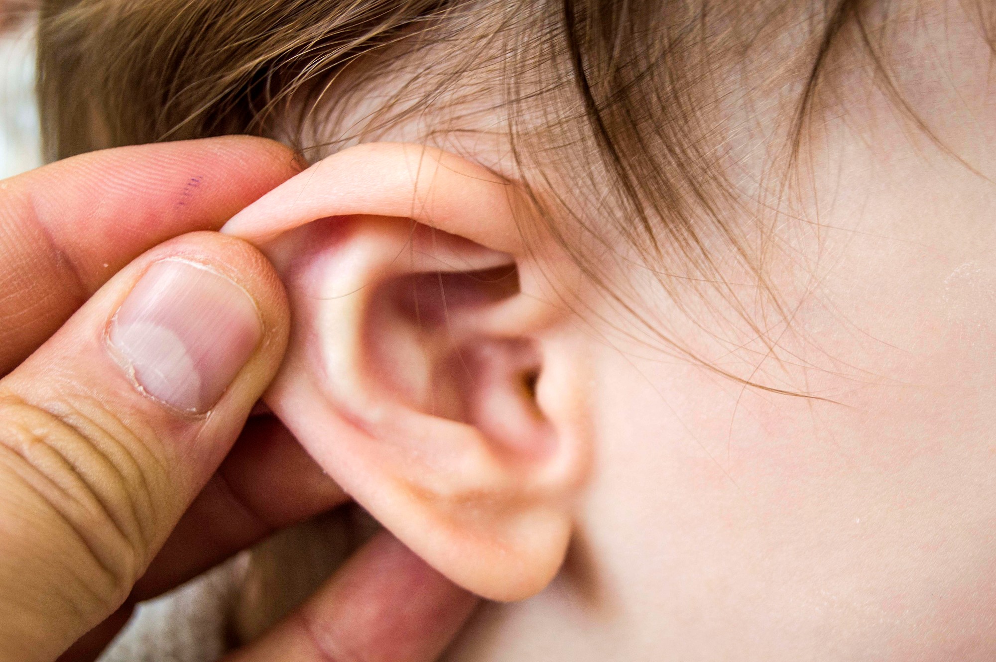 Ear Infections