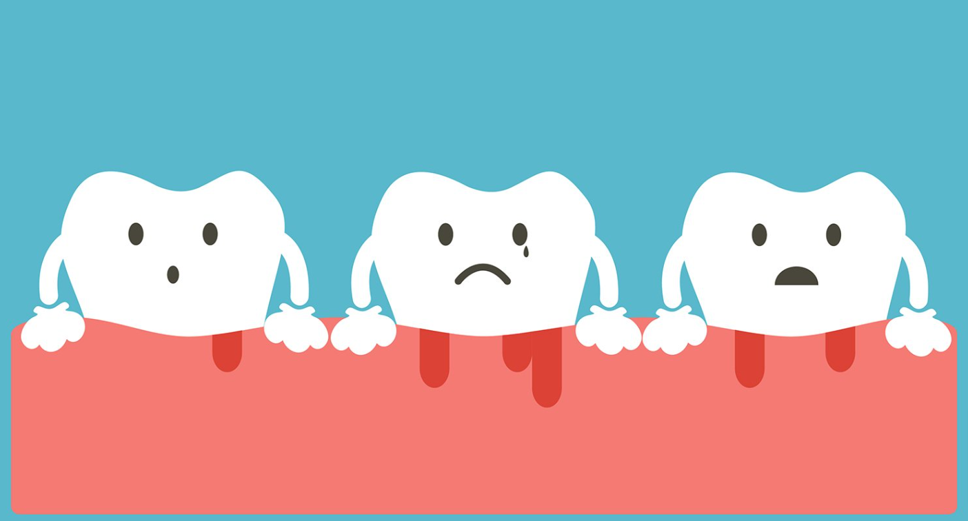 Different Symptoms, Causes, Treatment, and Preventive Measures of Periodontal Disease