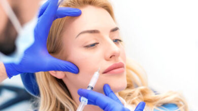 PRP under eye treatment