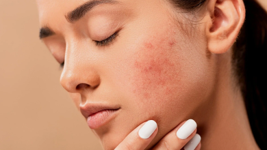 How to get rid of acne?