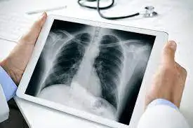 Everything You Need to Know About Digital X-Rays